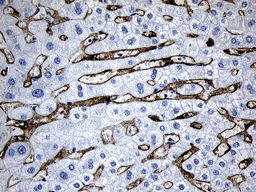 CLEC4M Antibody in Immunohistochemistry (Paraffin) (IHC (P))