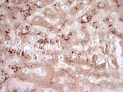 CLOCK Antibody in Immunohistochemistry (Paraffin) (IHC (P))