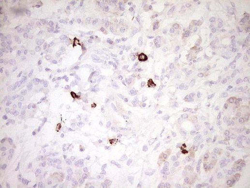 CLOCK Antibody in Immunohistochemistry (Paraffin) (IHC (P))