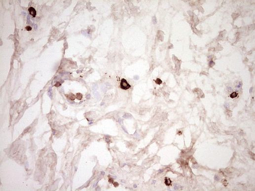 CLOCK Antibody in Immunohistochemistry (Paraffin) (IHC (P))