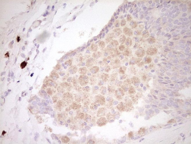 CLOCK Antibody in Immunohistochemistry (Paraffin) (IHC (P))