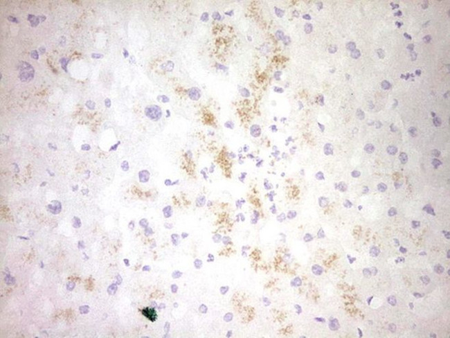 CLOCK Antibody in Immunohistochemistry (Paraffin) (IHC (P))