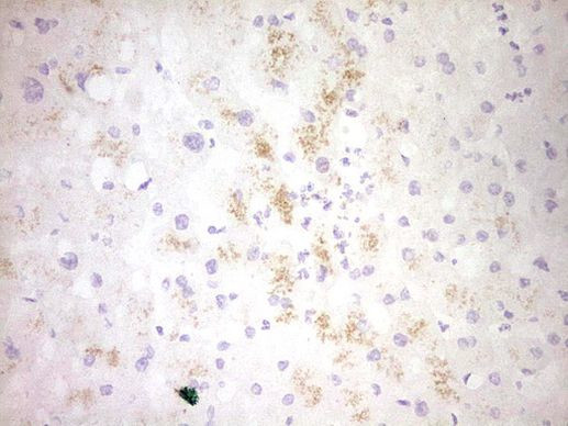 CLOCK Antibody in Immunohistochemistry (Paraffin) (IHC (P))