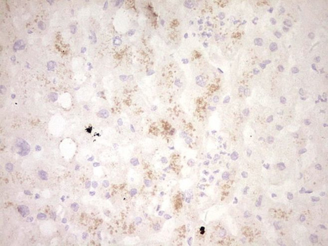 CLOCK Antibody in Immunohistochemistry (Paraffin) (IHC (P))