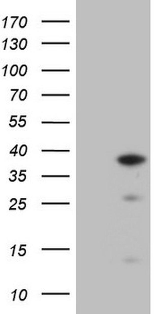 CLOCK Antibody in Western Blot (WB)