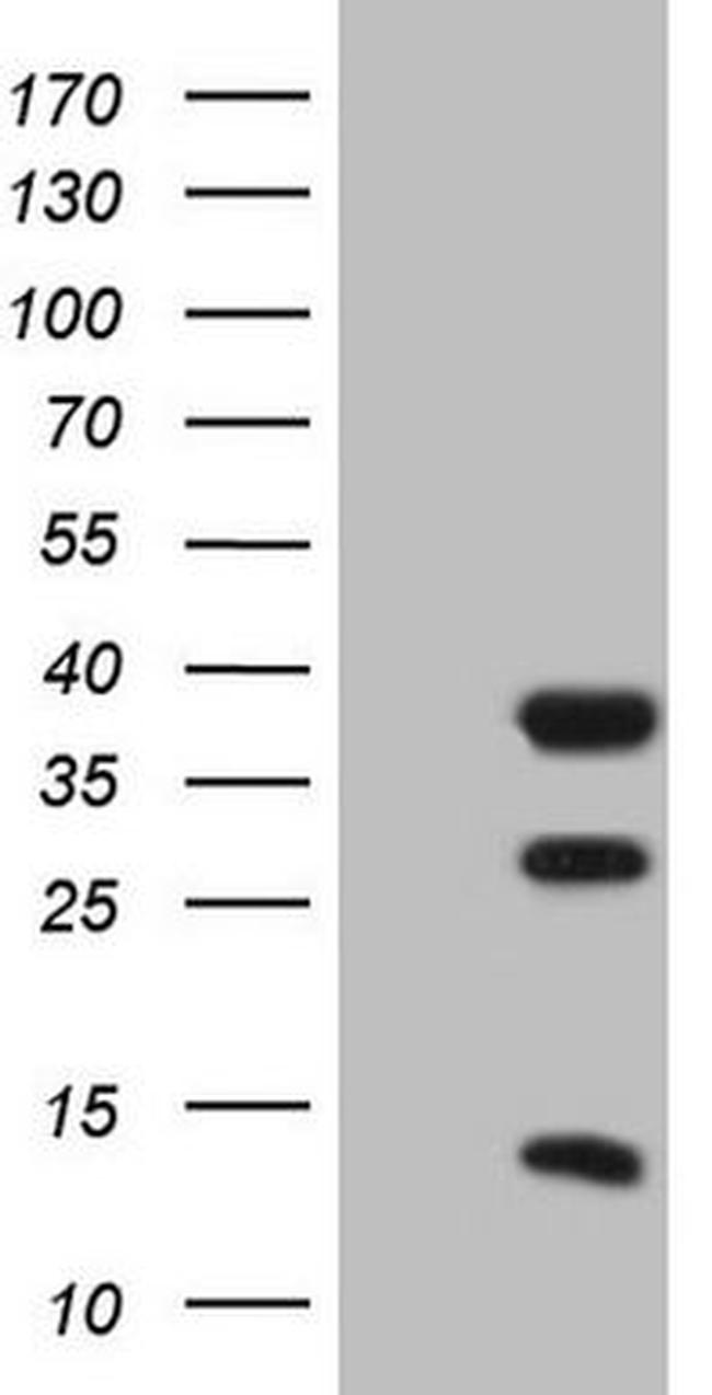 CLOCK Antibody in Western Blot (WB)