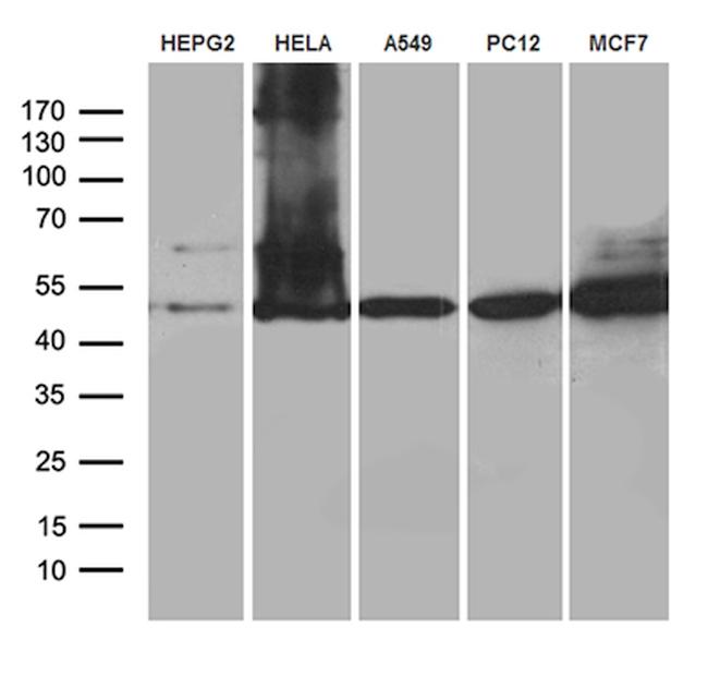 CLP1 Antibody in Western Blot (WB)