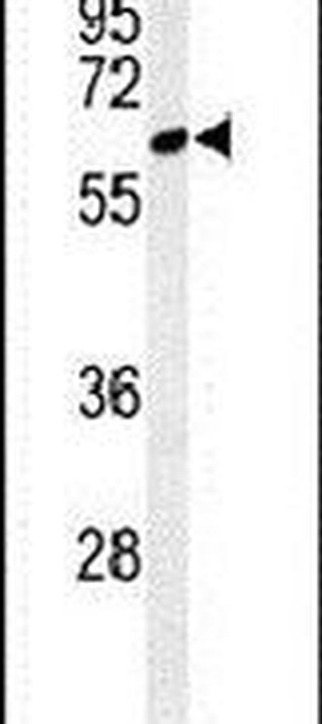 CLPB Antibody in Western Blot (WB)