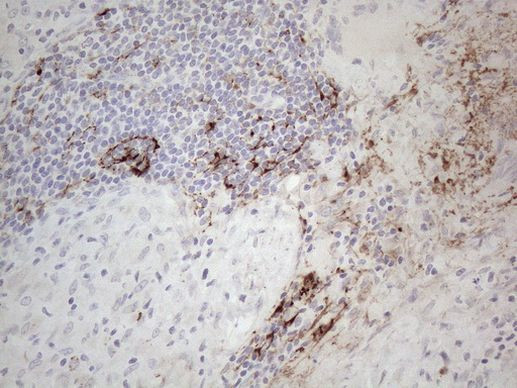 CLU Antibody in Immunohistochemistry (Paraffin) (IHC (P))