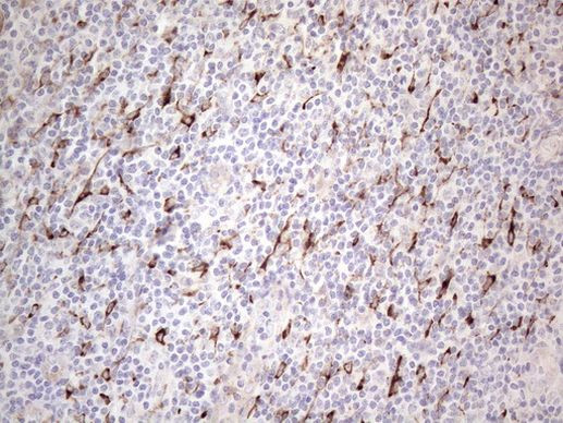 CLU Antibody in Immunohistochemistry (Paraffin) (IHC (P))