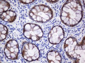 CMPK1 Antibody in Immunohistochemistry (Paraffin) (IHC (P))