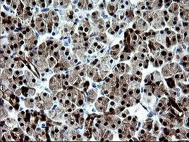 CMPK1 Antibody in Immunohistochemistry (Paraffin) (IHC (P))