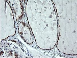 CMPK1 Antibody in Immunohistochemistry (Paraffin) (IHC (P))