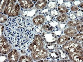 CMPK1 Antibody in Immunohistochemistry (Paraffin) (IHC (P))