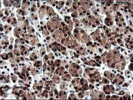 CMPK1 Antibody in Immunohistochemistry (Paraffin) (IHC (P))