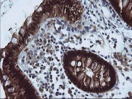 CMPK1 Antibody in Immunohistochemistry (Paraffin) (IHC (P))