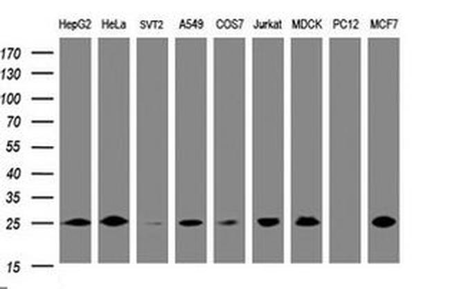 CMPK1 Antibody in Western Blot (WB)