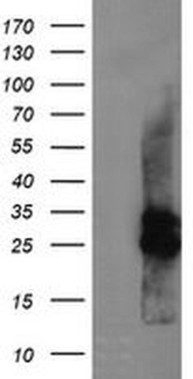 CMPK1 Antibody in Western Blot (WB)