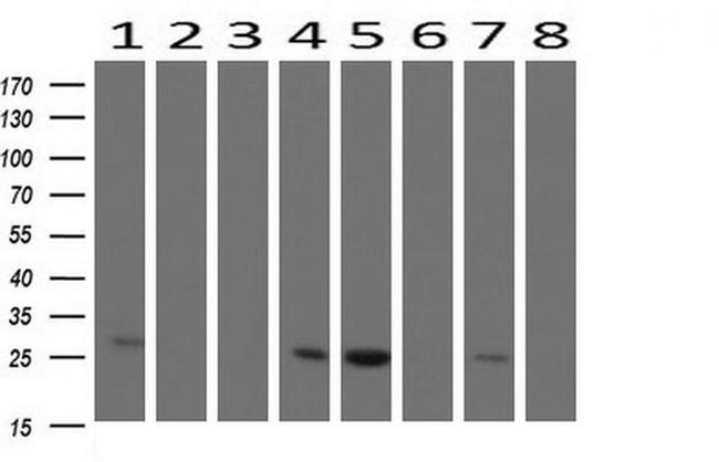 CMPK1 Antibody in Western Blot (WB)