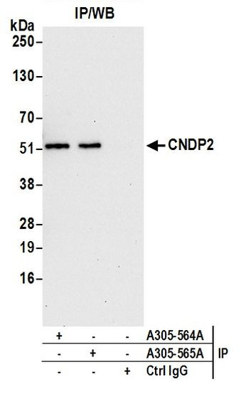 CNDP2 Antibody in Immunoprecipitation (IP)