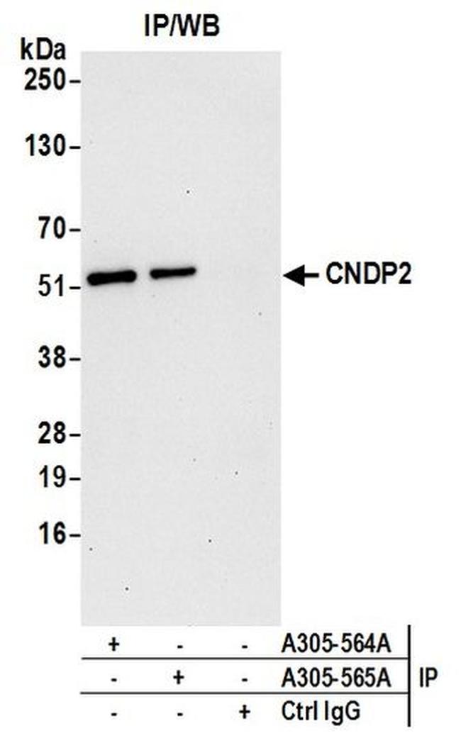 CNDP2 Antibody in Western Blot (WB)