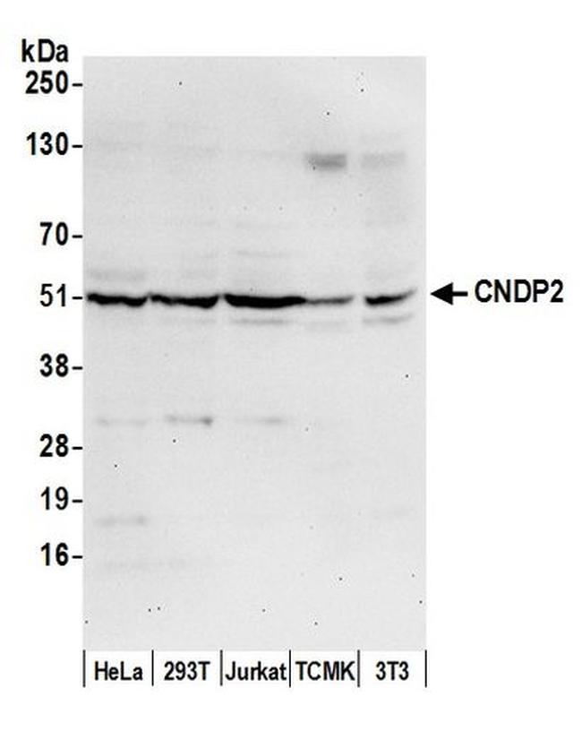 CNDP2 Antibody in Western Blot (WB)