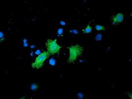 CNDP2 Antibody in Immunocytochemistry (ICC/IF)