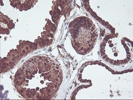 CNDP2 Antibody in Immunohistochemistry (Paraffin) (IHC (P))