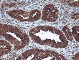 CNDP2 Antibody in Immunohistochemistry (Paraffin) (IHC (P))