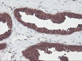 CNDP2 Antibody in Immunohistochemistry (Paraffin) (IHC (P))