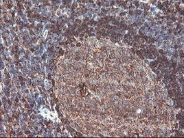 CNDP2 Antibody in Immunohistochemistry (Paraffin) (IHC (P))