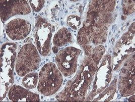 CNDP2 Antibody in Immunohistochemistry (Paraffin) (IHC (P))