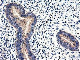 CNDP2 Antibody in Immunohistochemistry (Paraffin) (IHC (P))