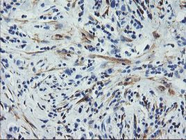 CNN2 Antibody in Immunohistochemistry (Paraffin) (IHC (P))