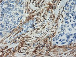 CNN2 Antibody in Immunohistochemistry (Paraffin) (IHC (P))