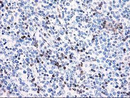 CNN2 Antibody in Immunohistochemistry (Paraffin) (IHC (P))