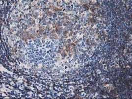 CNN2 Antibody in Immunohistochemistry (Paraffin) (IHC (P))