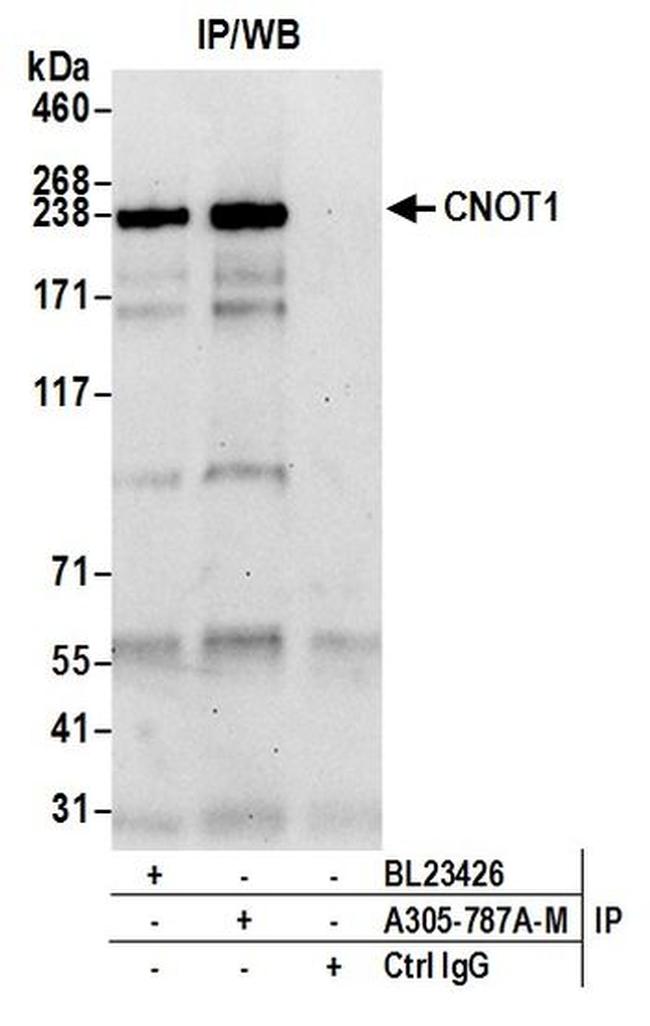 CNOT1 Antibody in Western Blot (WB)