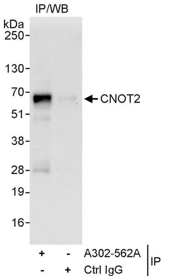 CNOT2 Antibody in Immunoprecipitation (IP)