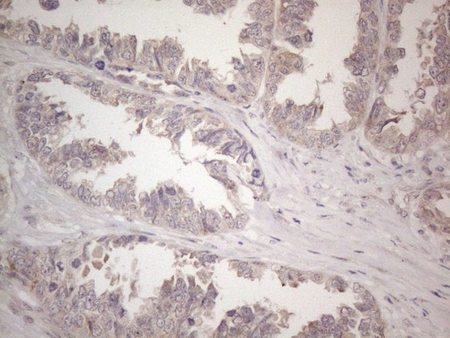 CNOT2 Antibody in Immunohistochemistry (Paraffin) (IHC (P))