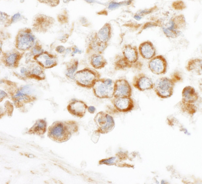 CNOT3 Antibody in Immunohistochemistry (IHC)