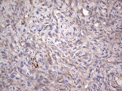 CNOT4 Antibody in Immunohistochemistry (Paraffin) (IHC (P))