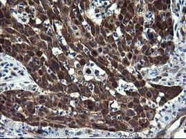 CNOT4 Antibody in Immunohistochemistry (Paraffin) (IHC (P))