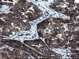 CNOT4 Antibody in Immunohistochemistry (Paraffin) (IHC (P))