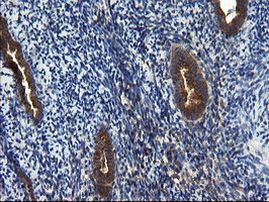 CNOT4 Antibody in Immunohistochemistry (Paraffin) (IHC (P))