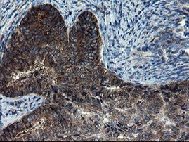 CNOT4 Antibody in Immunohistochemistry (Paraffin) (IHC (P))