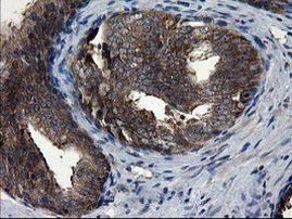 CNOT4 Antibody in Immunohistochemistry (Paraffin) (IHC (P))