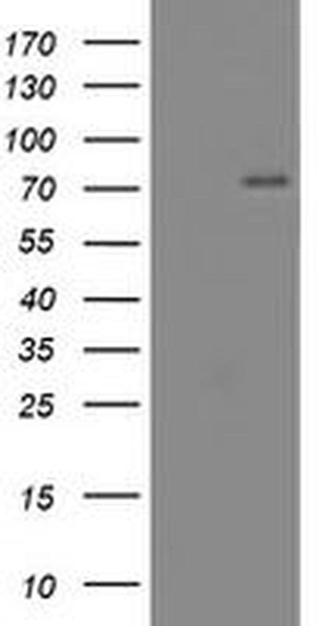 CNOT4 Antibody in Western Blot (WB)