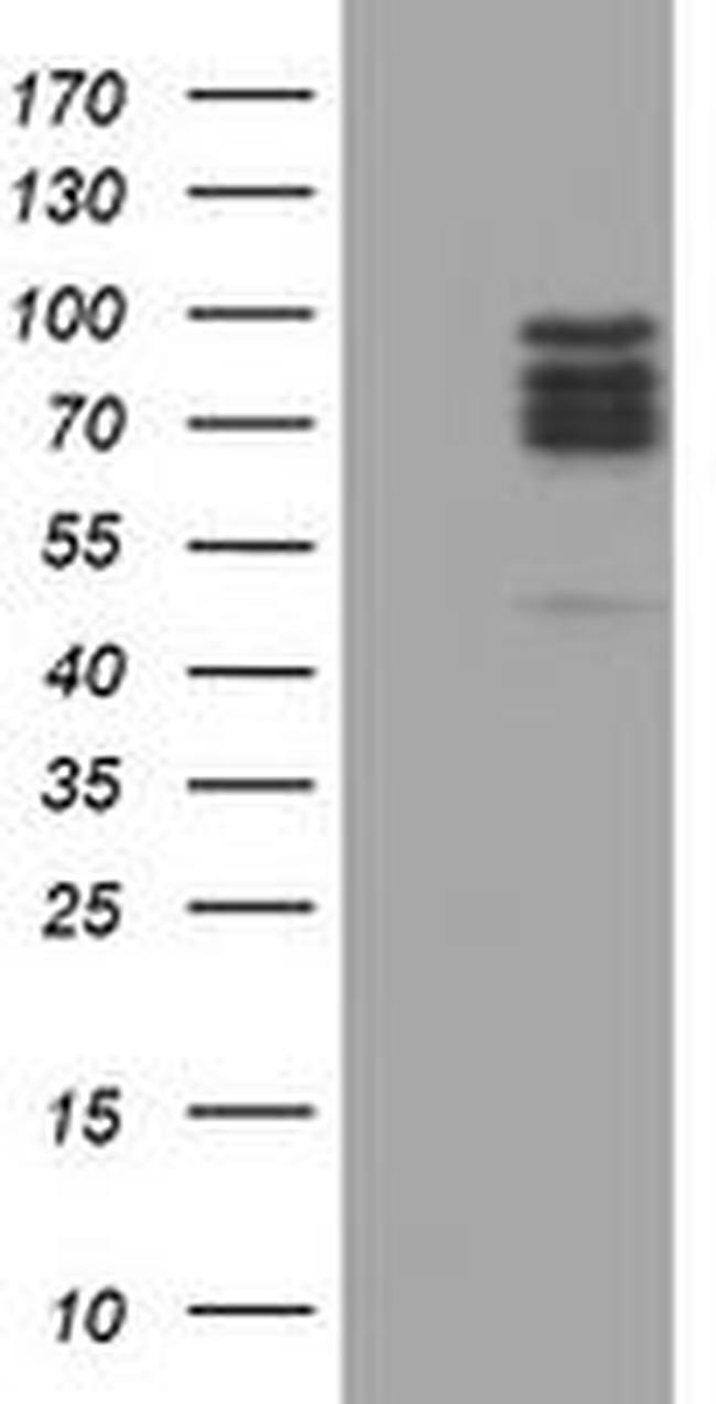 CNOT4 Antibody in Western Blot (WB)