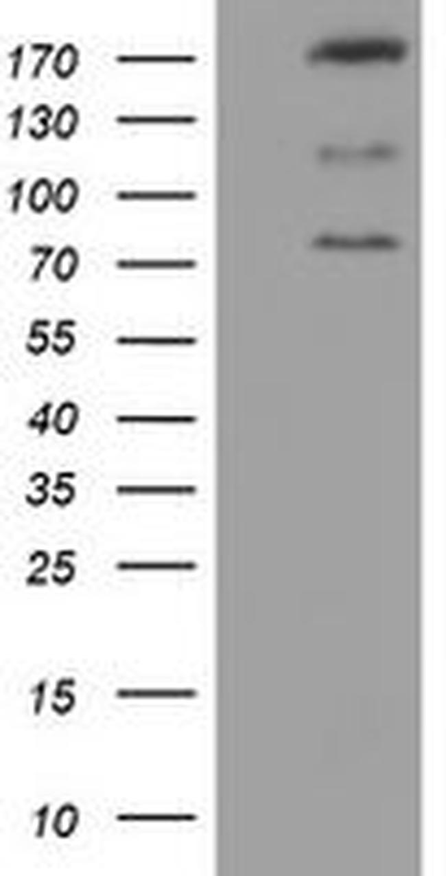 CNOT4 Antibody in Western Blot (WB)